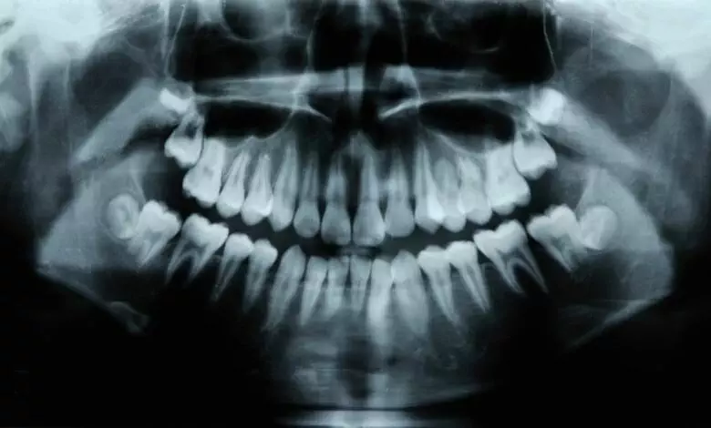 Dental X rays