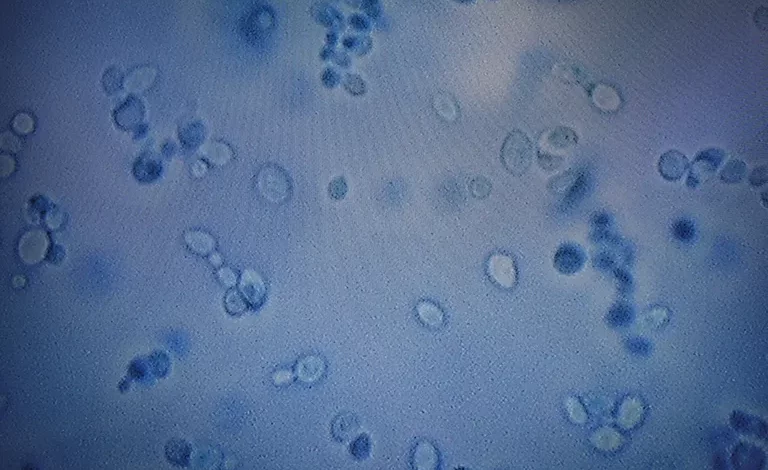 Inactive Candida auris deadly fungus